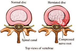 vertebrae