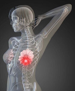 Breast Cancer Screening X-Ray