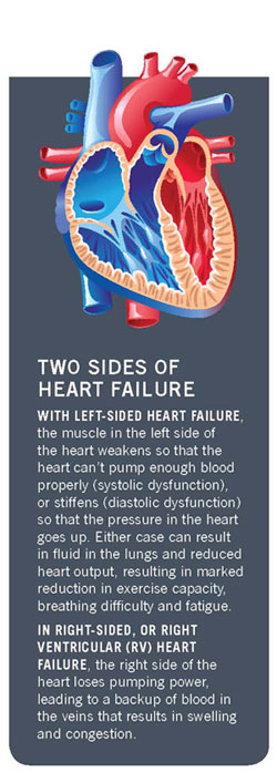 2 sides of heart failure