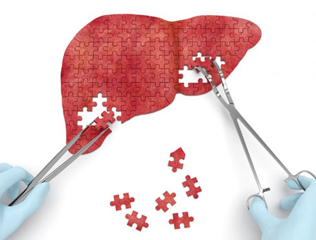 The challenge of Liver Disease
