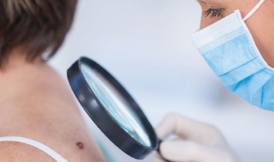 Doctor Looking at a Mole