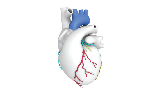 visual representation of a patient's heart, done with HeartFlow analysis, which uses Fractional Flow Reserve CT (FFR-CT) technology