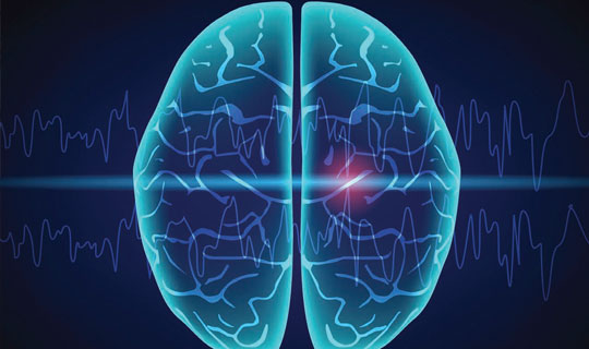 illustration of a brain