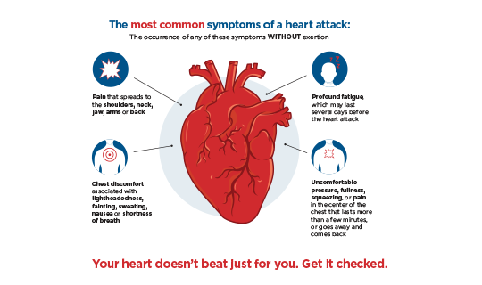 These are the most common heart attack symptoms according to a study