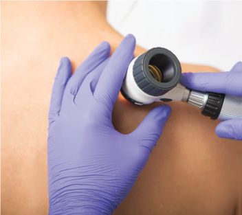 Lunch & Learn: Brachytherapy Treatment for Skin Cancer with Dr. Deborah Smith (hybrid)
