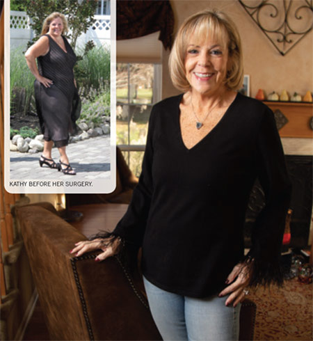 Kathy Hein before and after bariatric surgery