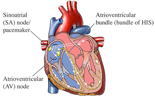 Heart Arrhythmias