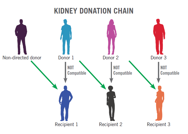 kidney donation chain infographic
